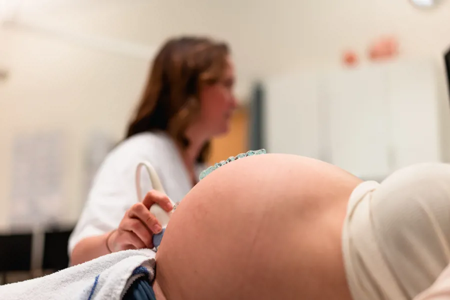 Bilde av gynekolog som gjør ultralyd på gravid mage